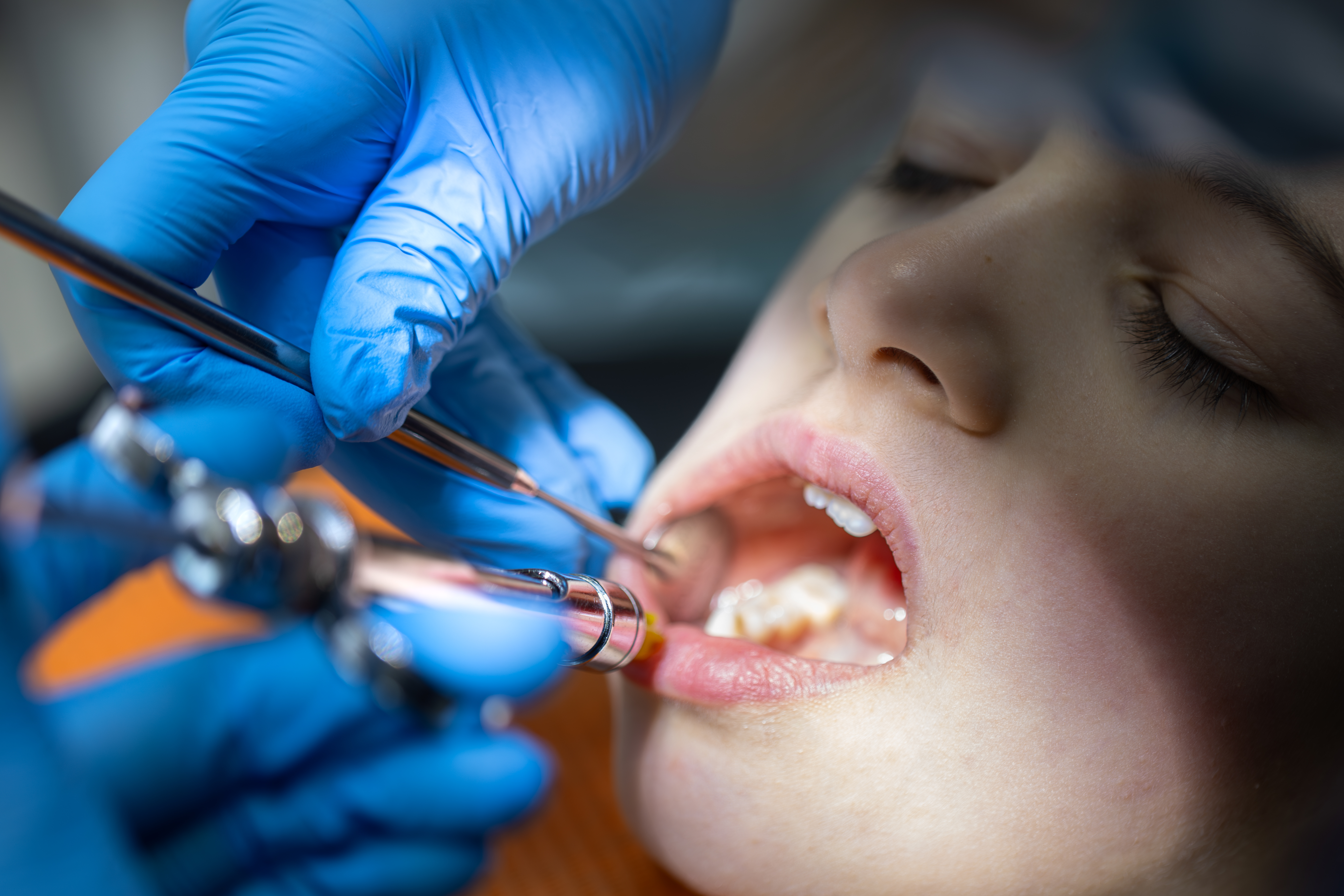 Aligner image 2