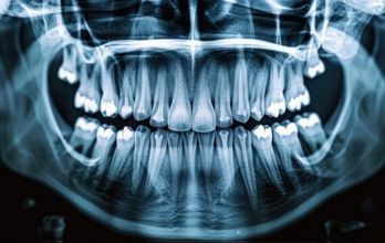Aligner image 1
