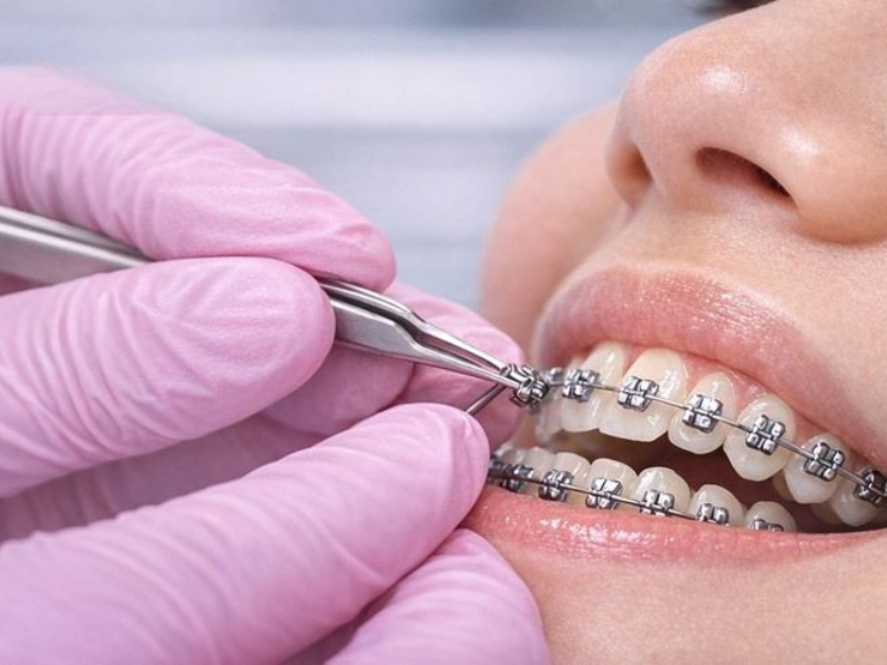 Child at dental clinic smiling